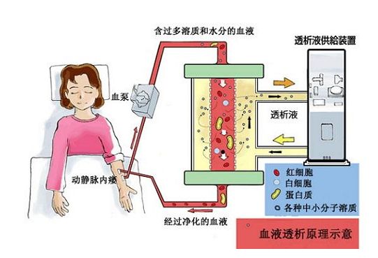 你要找的住院血透在恩华！！！